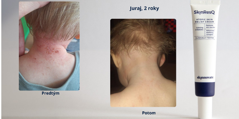 Jurko_2roky_malý